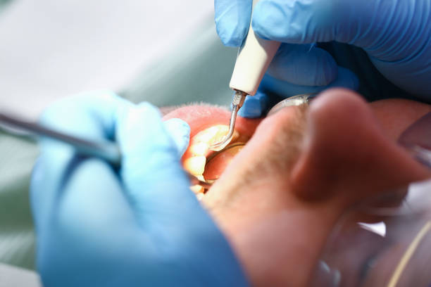 Best Tooth Infection Emergency Dentist  in Eastmont, WA