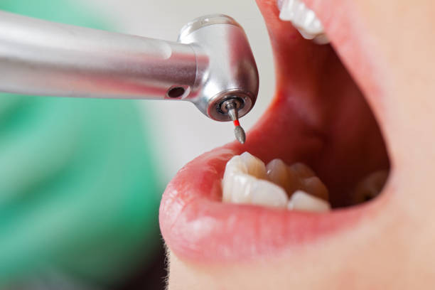 Best Broken Tooth Emergency  in Eastmont, WA